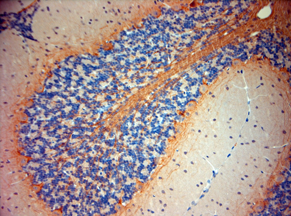 P2RX7 Antibody in Immunohistochemistry (Paraffin) (IHC (P))