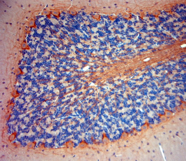 P2RX7 Antibody in Immunohistochemistry (Paraffin) (IHC (P))