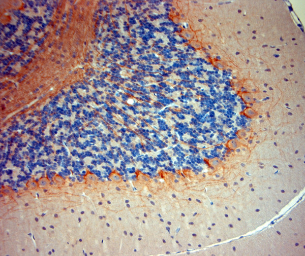 P2RX7 Antibody in Immunohistochemistry (Paraffin) (IHC (P))