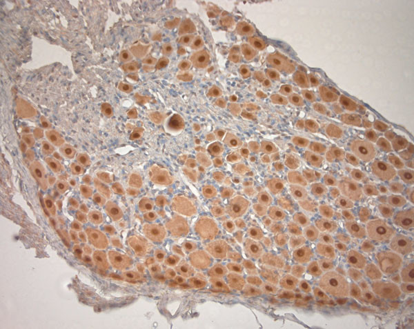 KCNH4 Antibody in Immunohistochemistry (Paraffin) (IHC (P))