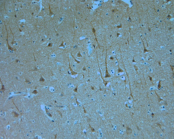 KCNQ1 Antibody in Immunohistochemistry (Paraffin) (IHC (P))