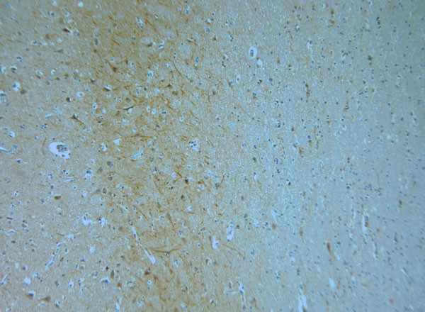 KCNQ1 Antibody in Immunohistochemistry (Paraffin) (IHC (P))