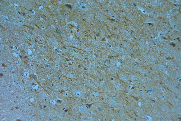 KCNQ1 Antibody in Immunohistochemistry (Paraffin) (IHC (P))