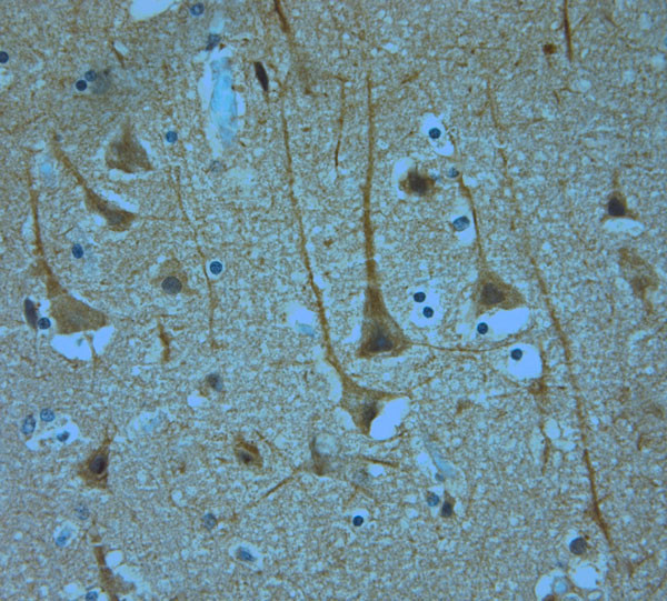 KCNQ1 Antibody in Immunohistochemistry (Paraffin) (IHC (P))