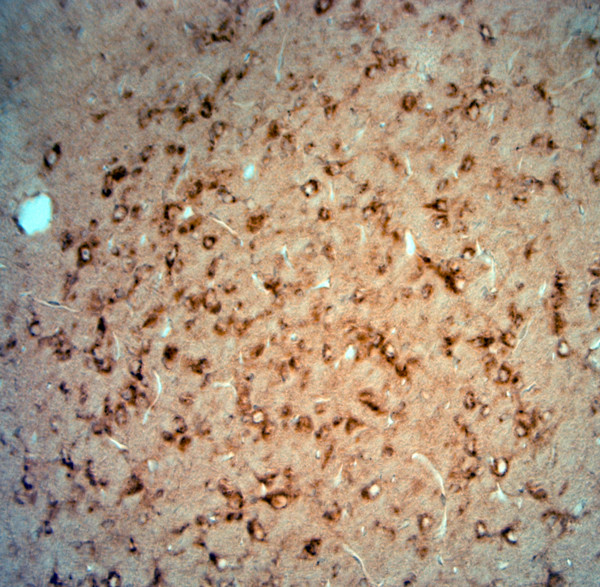 PIST Antibody in Immunohistochemistry (Paraffin) (IHC (P))