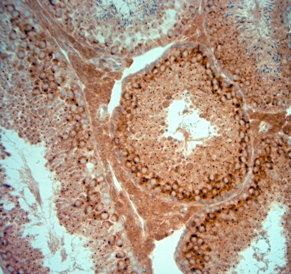 PIST Antibody in Immunohistochemistry (Paraffin) (IHC (P))