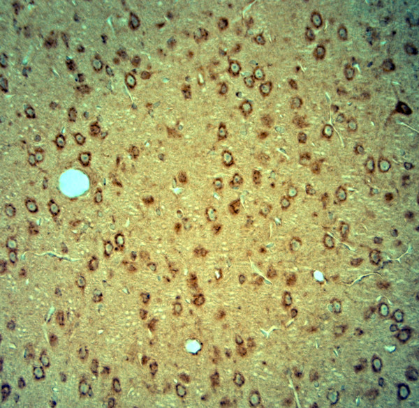 PIST Antibody in Immunohistochemistry (Paraffin) (IHC (P))