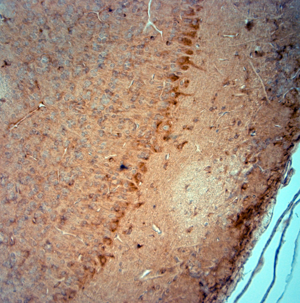 PIST Antibody in Immunohistochemistry (Paraffin) (IHC (P))