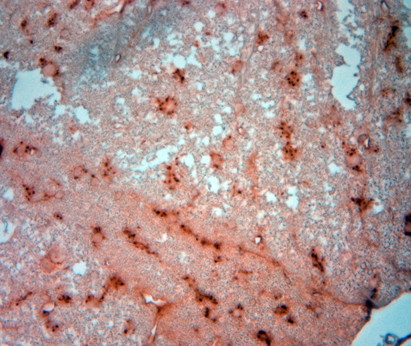 PIST Antibody in Immunohistochemistry (Paraffin) (IHC (P))