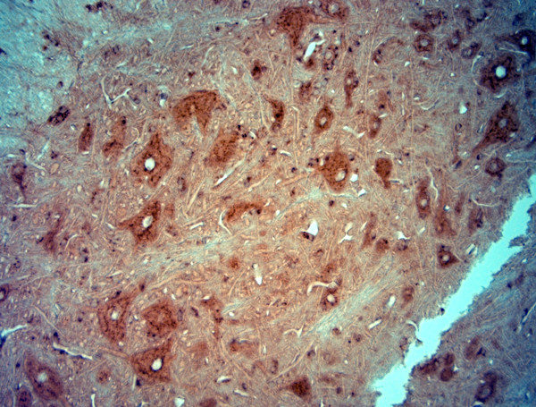 PIST Antibody in Immunohistochemistry (Paraffin) (IHC (P))