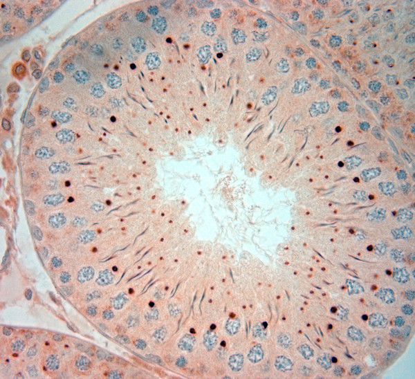 PIST Antibody in Immunohistochemistry (Paraffin) (IHC (P))