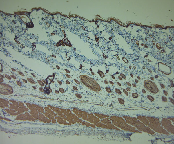 P2RY1 Antibody in Immunohistochemistry (Paraffin) (IHC (P))