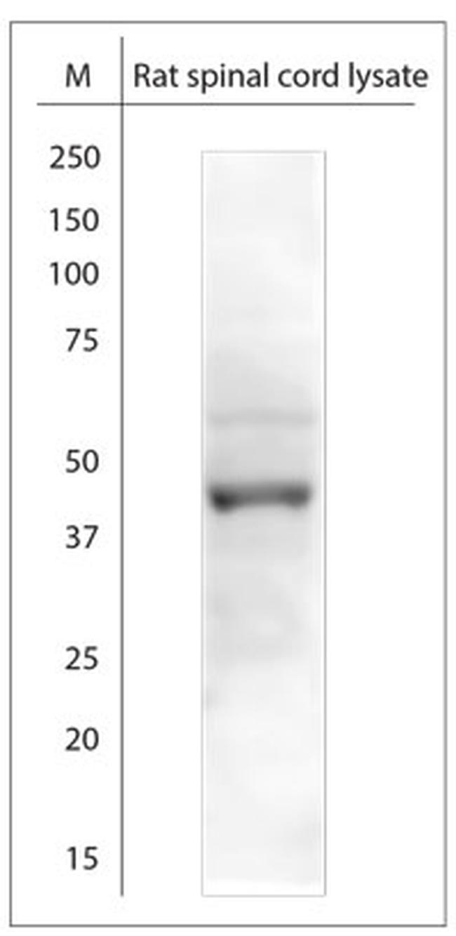 KCNJ10 Antibody in Western Blot (WB)