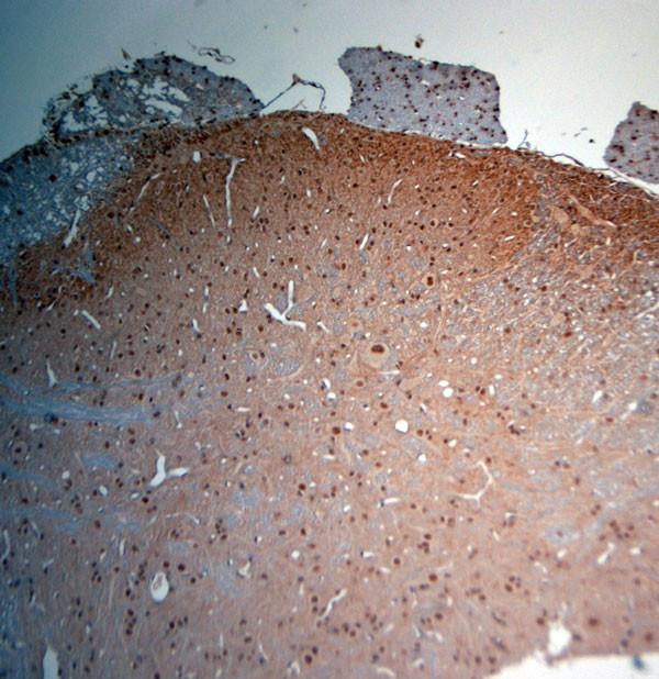 KCNH2 Antibody in Immunohistochemistry (Paraffin) (IHC (P))