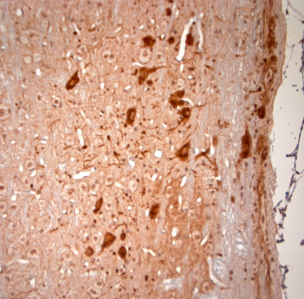 KCNH2 Antibody in Immunohistochemistry (Paraffin) (IHC (P))