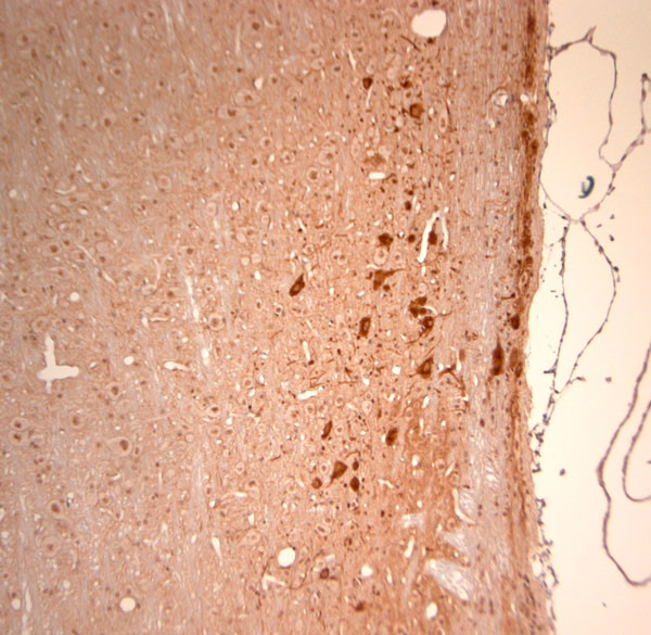 KCNH2 Antibody in Immunohistochemistry (Paraffin) (IHC (P))