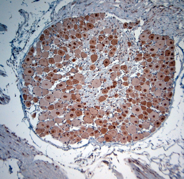 KCNH2 Antibody in Immunohistochemistry (Paraffin) (IHC (P))