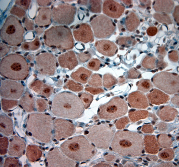 KCNH2 Antibody in Immunohistochemistry (Paraffin) (IHC (P))