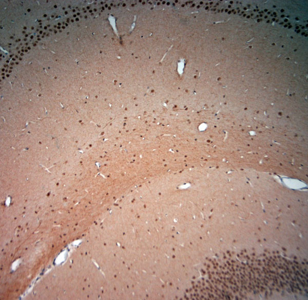 KCNH2 Antibody in Immunohistochemistry (Paraffin) (IHC (P))