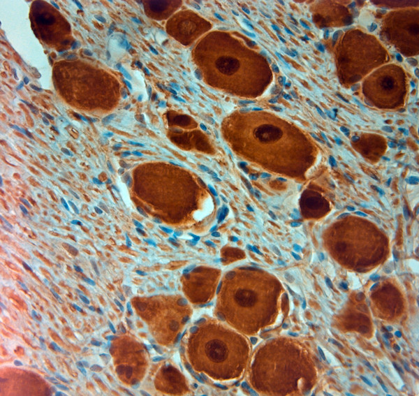 PGP 9.5 Antibody in Immunohistochemistry (Paraffin) (IHC (P))