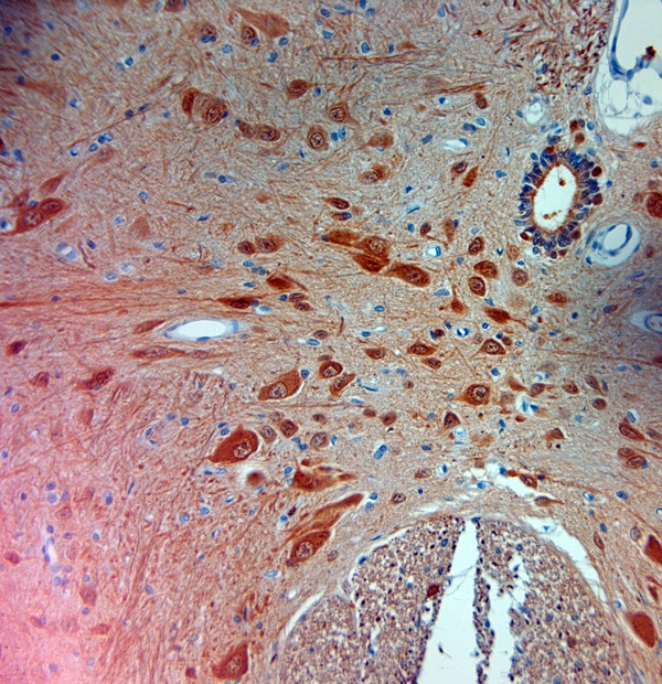 PGP 9.5 Antibody in Immunohistochemistry (Paraffin) (IHC (P))