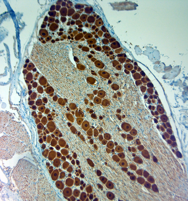 PGP 9.5 Antibody in Immunohistochemistry (Paraffin) (IHC (P))