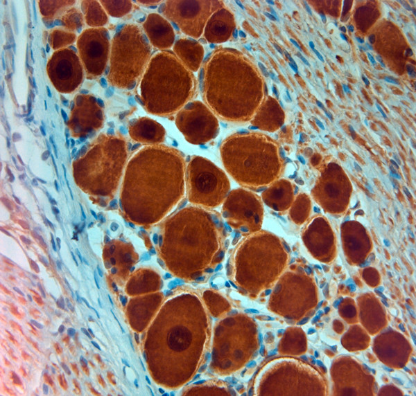 PGP 9.5 Antibody in Immunohistochemistry (Paraffin) (IHC (P))