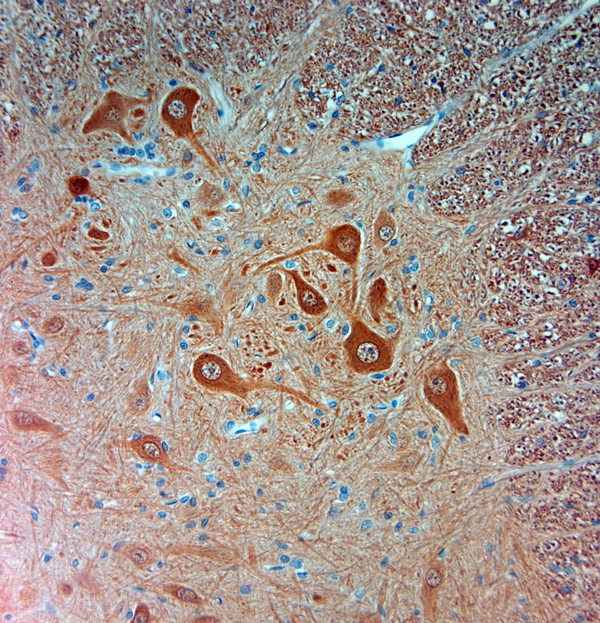 PGP 9.5 Antibody in Immunohistochemistry (Paraffin) (IHC (P))