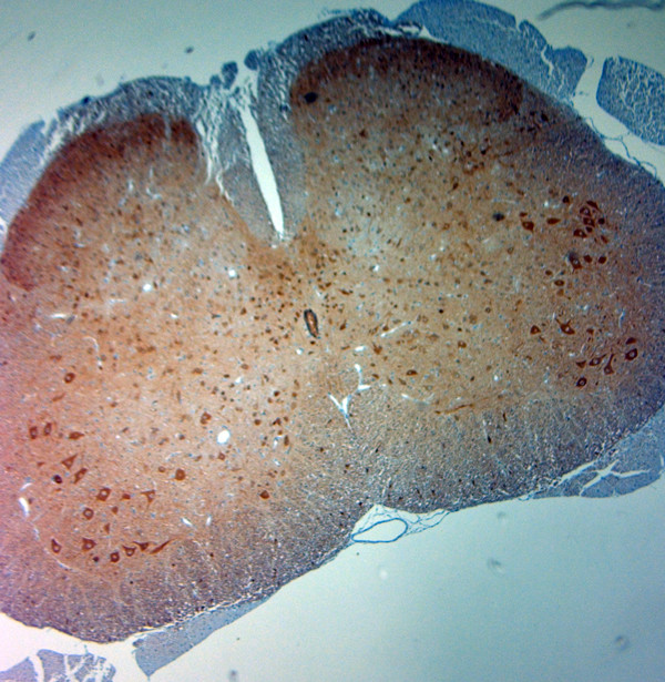 PGP 9.5 Antibody in Immunohistochemistry (Paraffin) (IHC (P))