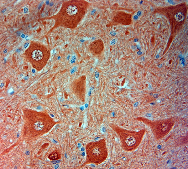 PGP 9.5 Antibody in Immunohistochemistry (Paraffin) (IHC (P))