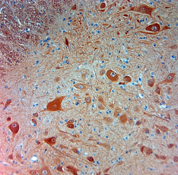 PGP 9.5 Antibody in Immunohistochemistry (Paraffin) (IHC (P))