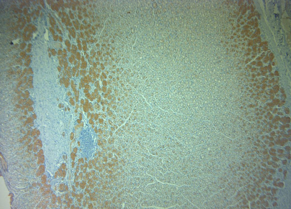 Pallidin Antibody in Immunohistochemistry (Paraffin) (IHC (P))