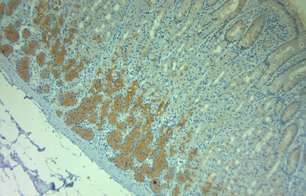 Pallidin Antibody in Immunohistochemistry (Paraffin) (IHC (P))