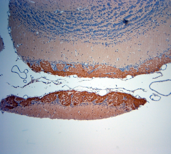 OMP Antibody in Immunohistochemistry (Paraffin) (IHC (P))