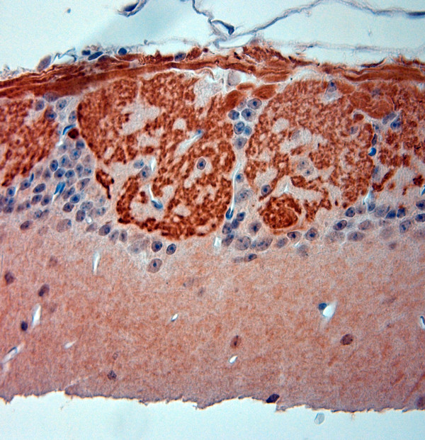 OMP Antibody in Immunohistochemistry (Paraffin) (IHC (P))