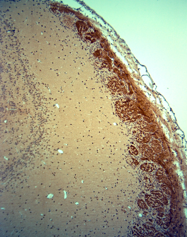 OMP Antibody in Immunohistochemistry (Paraffin) (IHC (P))