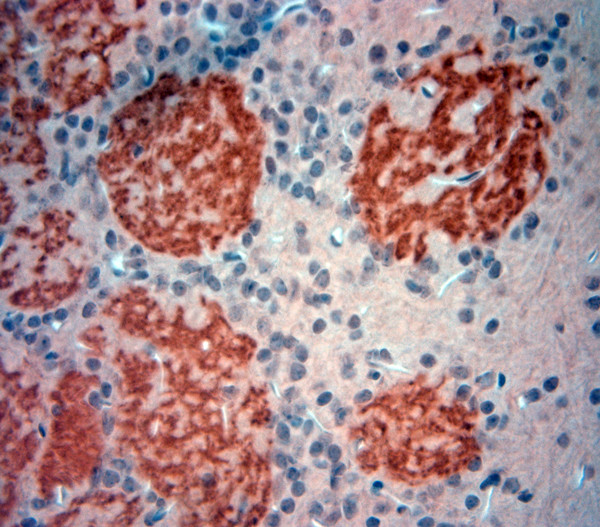 OMP Antibody in Immunohistochemistry (Paraffin) (IHC (P))