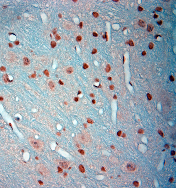 cFos Antibody in Immunohistochemistry (Paraffin) (IHC (P))