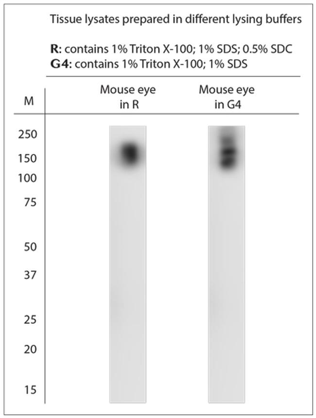 TRPM1 Antibody in Western Blot (WB)