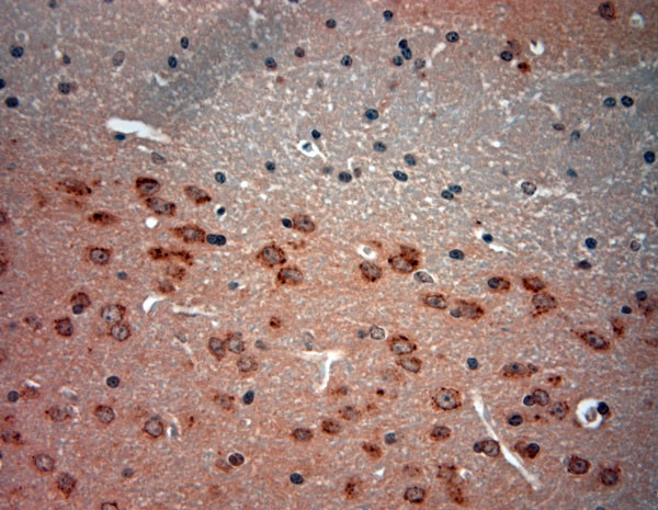 Mucolipin 1 Antibody in Immunohistochemistry (Paraffin) (IHC (P))