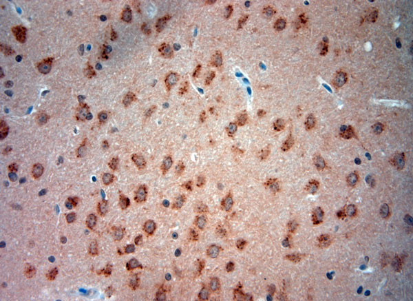 Mucolipin 1 Antibody in Immunohistochemistry (Paraffin) (IHC (P))