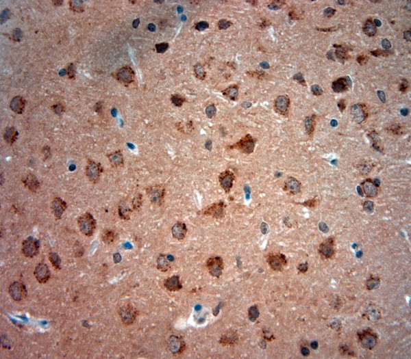 Mucolipin 1 Antibody in Immunohistochemistry (Paraffin) (IHC (P))