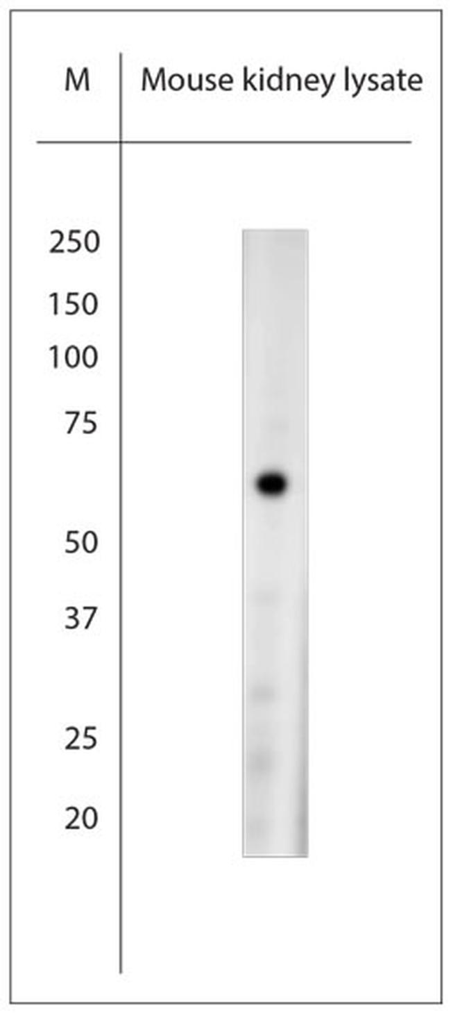Mucolipin 1 Antibody in Western Blot (WB)