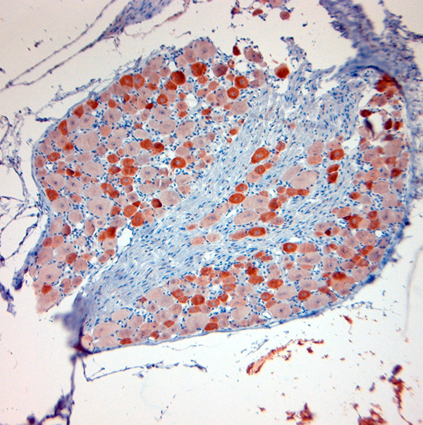 TRPV1 Antibody in Immunohistochemistry (Paraffin) (IHC (P))