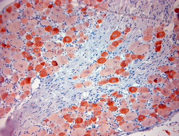 TRPV1 Antibody in Immunohistochemistry (Paraffin) (IHC (P))