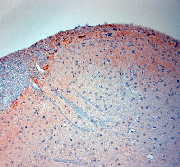 TRPV1 Antibody in Immunohistochemistry (Paraffin) (IHC (P))