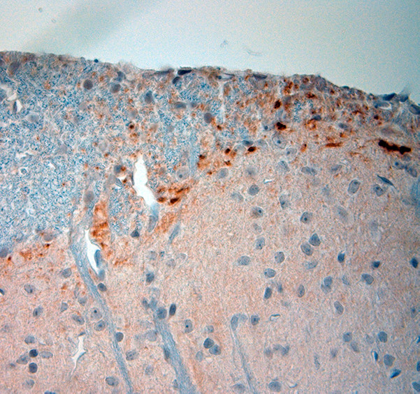 TRPV1 Antibody in Immunohistochemistry (Paraffin) (IHC (P))