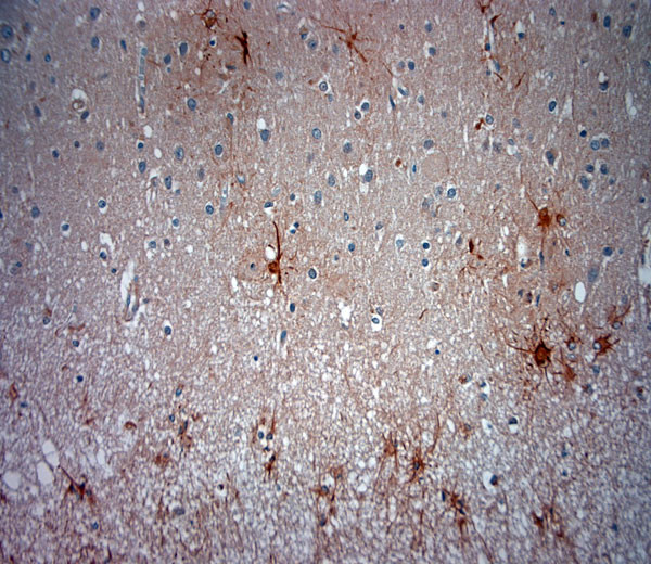 ASIC3 Antibody in Immunohistochemistry (Paraffin) (IHC (P))