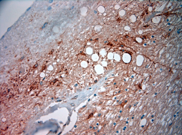 ASIC3 Antibody in Immunohistochemistry (Paraffin) (IHC (P))