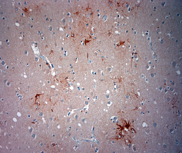 ASIC3 Antibody in Immunohistochemistry (Paraffin) (IHC (P))